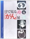 目で見るがん展