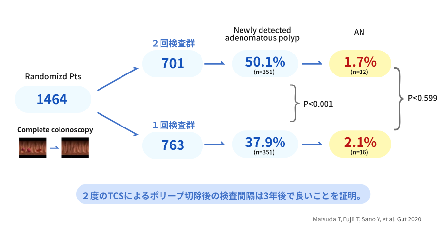 2度のTCSによるポリープ切除後の検査間隔は3年後で良いことを証明。